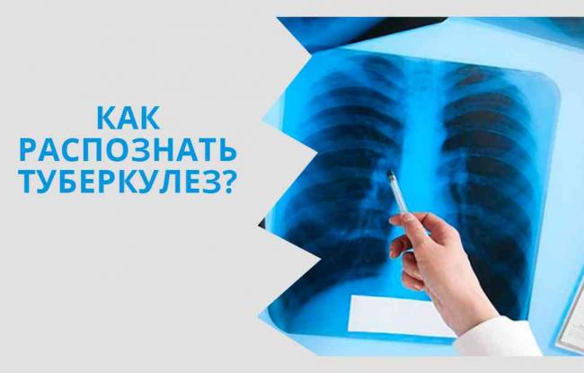 Туберкулез заразный или нет: разбираемся окончательно!