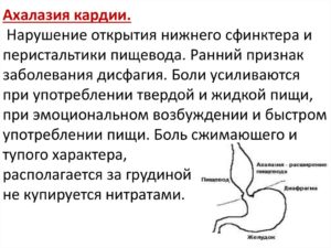 Недостаточность кардии желудка симптомы и лечение