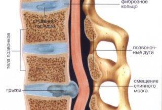 Что делать, когда болит крестец? причины боли в области крестца