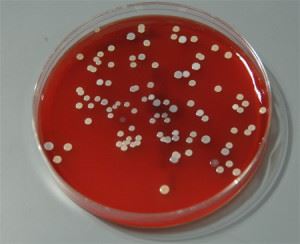 Тинкториальные свойства бактерий. методы окраски
