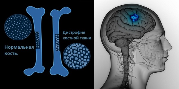 Исследование состава газированных напитков, их влияния на здоровье человека