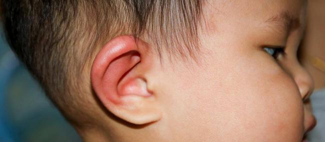 Серная пробка в ухе у ребенка (25 фото): как выглядит пробка в ухе и как вытащить ее в домашних условиях, почистить ухо и удалить ее самостоятельно