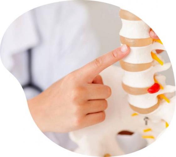Спондилолистез (смещение позвонков): симптомы и лечение
