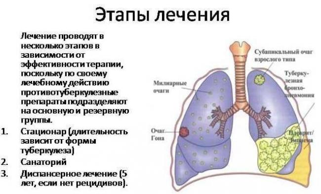 Таблетки от туберкулеза: как принимать, названия и какие пьют?