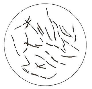 Азот почвы. круговорот азота в природе. биологическое связывание азота микробами-азотфиксаторами