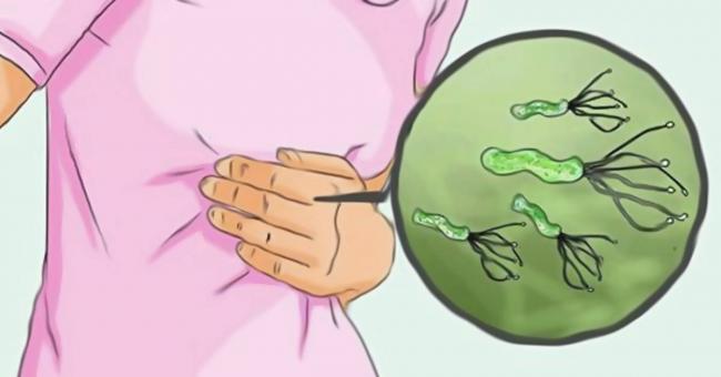 Хеликобактер пилори – лечение народными средствами, что такое хеликобактер пилори?