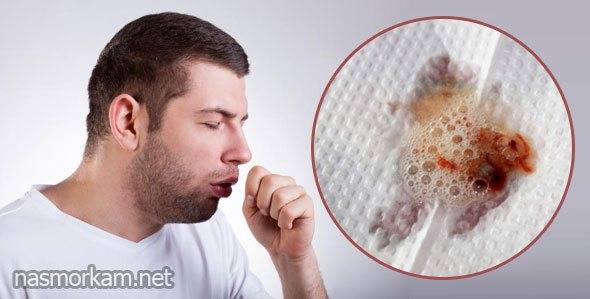 Что делать если с кашлем отхаркивается кровь?