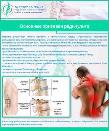 Что лучше узи или снимок позвоночника?