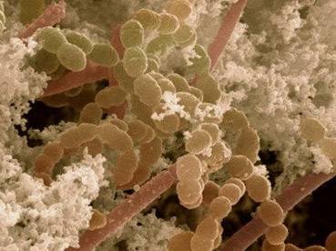 Группа молочнокислых бактерий: их физиолого-биохимические особенности, практическое значение, характеристика патогенных представителей молочнокислых бактерий