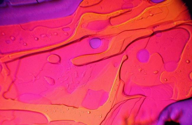 Польза и вред бактерий для человеческого организма