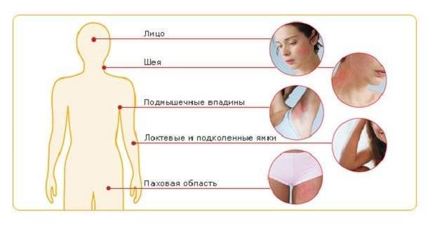 Мазь для наружного применения Акрихин Акридерм - отзывы