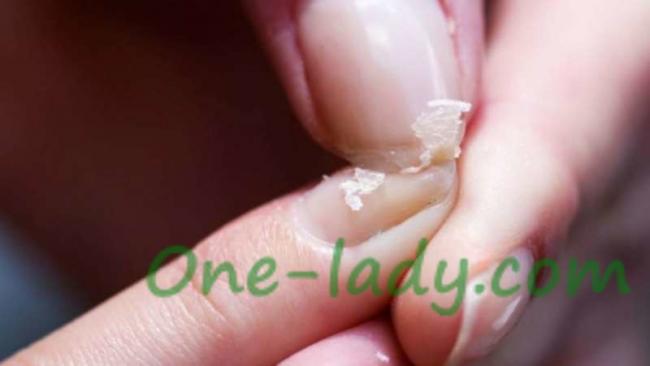 Ногти слоятся и ломаются: причины проблемы и лечение