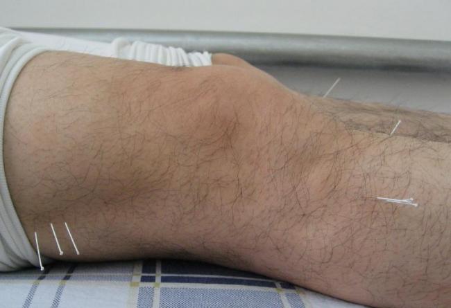 Болит копчик, когда сидишь и встаешь: причины, лечение