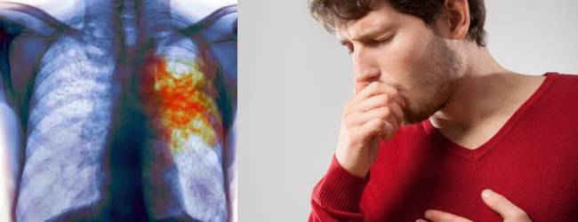 Отхаркивание с кровью — причины