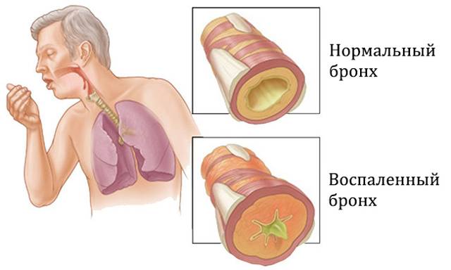 Собачий жир лечебные свойства детям