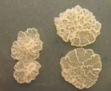 Размножаются бактерии путем деления и делают это очень быстро