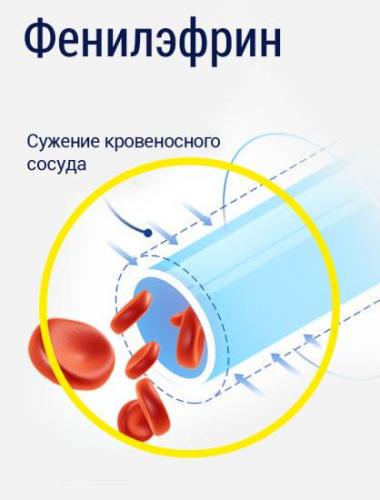 Наружный геморрой: симптомы, причины и лечение