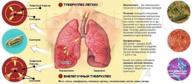 Таблетки для профилактики туберкулеза у детей и взрослых