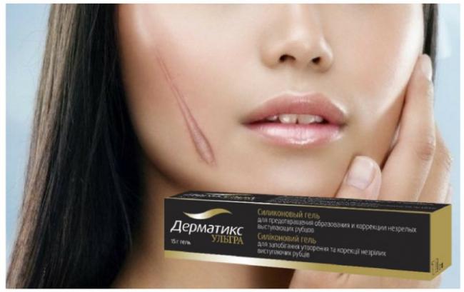 Отзывы на дерматикс гель для коррекции рубцов и способ применения