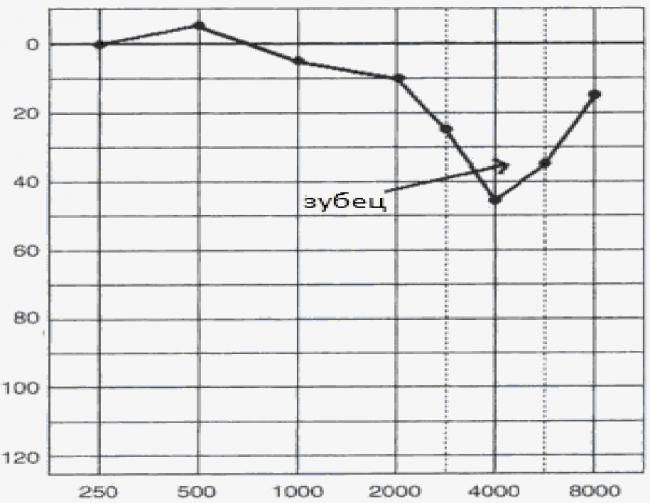 Шум в ушах и голове - что делать? причины и лечение