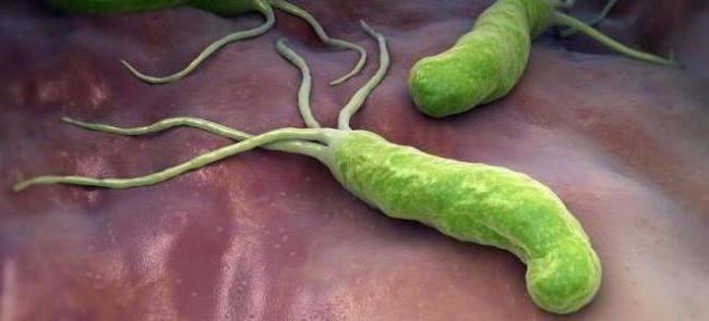 Хеликобактер пилори. комплексное лечение антибиотиками. когда и какими?