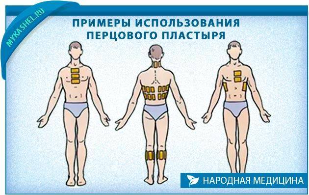 Перцовый пластырь при бронхите