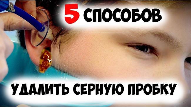 Как убрать серную пробку в ухе у ребенка?