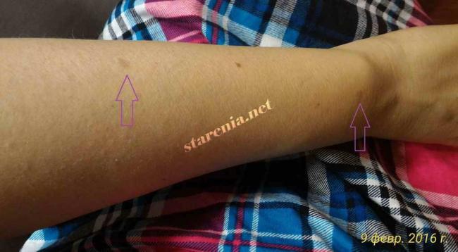 Инструкция по применению ПОЛИОКСИДОНИЙ POLYOXIDONIUM лиофилизат 6 мг