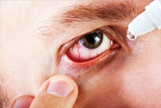Возвращаем глазам нормальный вид: методы лечения конъюнктивита у детей и перечень препаратов