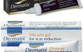 Аптечные средства от рубцов. сравнение, «фишки», алгоритм выбора