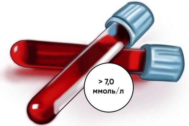 Норма сахара у женщин