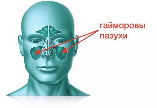 Антибиотики при гайморите у взрослых отзывы