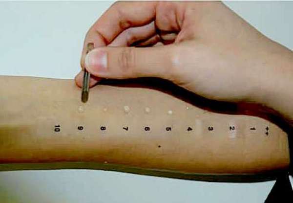 Как узнать аллергия это или простуда