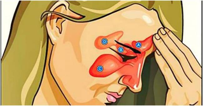 Желтые сопли у взрослого, их причины и лечение