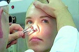 Гнойный гайморит: лечение в домашних условиях, симптомы, что делать