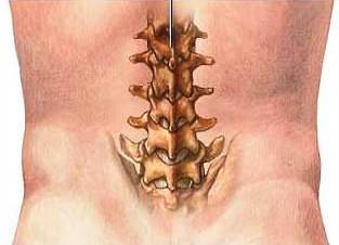 Спондилолистез шейного и пояснично-крестцового отдела позвоночника: что это, лечение