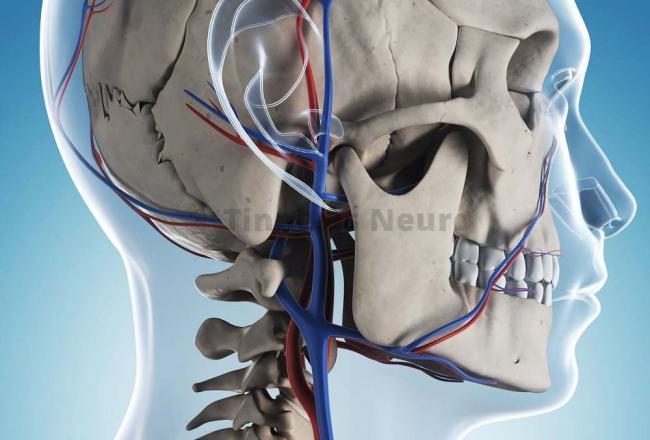 Звон в ушах и голове. причины постоянный, сильный, лечение, препараты, лекарства, народные средства