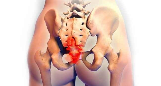 Боли в копчике: причины и характер болевых ощущений