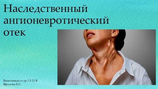 Отек квинке – экстренные меры, дальнейшее лечение и профилактика