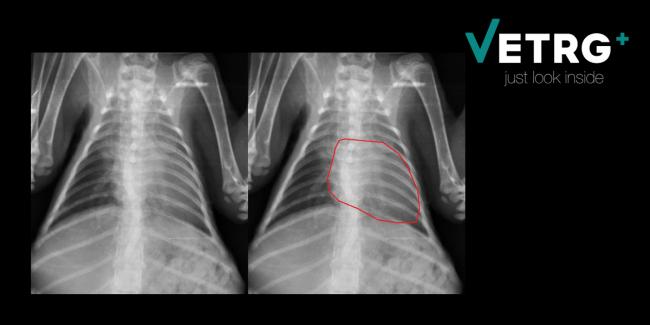 Ателектаз легких у детей