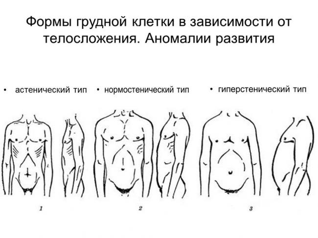 Деформации грудной клетки - виды, описание, симптомы и причины