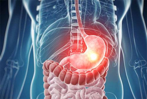 Недостаточность кардии желудка лечение народные средства