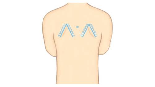 Как правильно выполнить лечение хрипов в бронхах народными средствами — проверенные способы