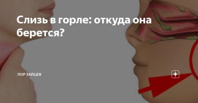 Постоянная мокрота в горле без кашля: причины и лечение