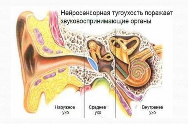 Как и чем лечить кохлеарный неврит слухового нерва. нейросенсорная тугоухость (кохлеарный неврит): причины, симптомы и лечение кохлеарный неврит слухового нерва симптомы лечение