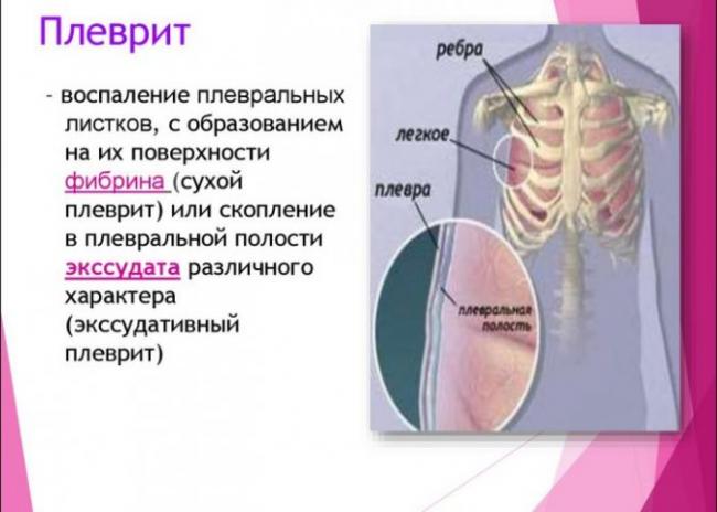 Чем опасен пневмосклероз?