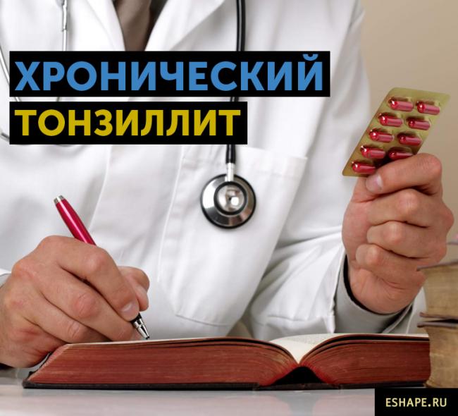 Хронический тонзиллит, лечение миндалин при хроническом тонзиллите без пробок хирургическим путем, казеозный детрит