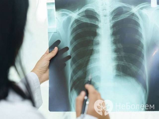 Чем отличается пневмония от внебольничной пневмонии