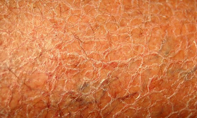 Эконазол аналоги. цены на аналоги в аптеках