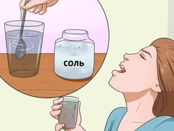 Чешется горло изнутри и появился кашель: что делать